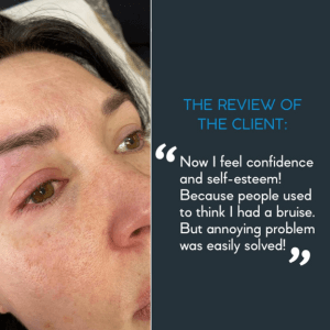 Client review visual after skin concern treatment